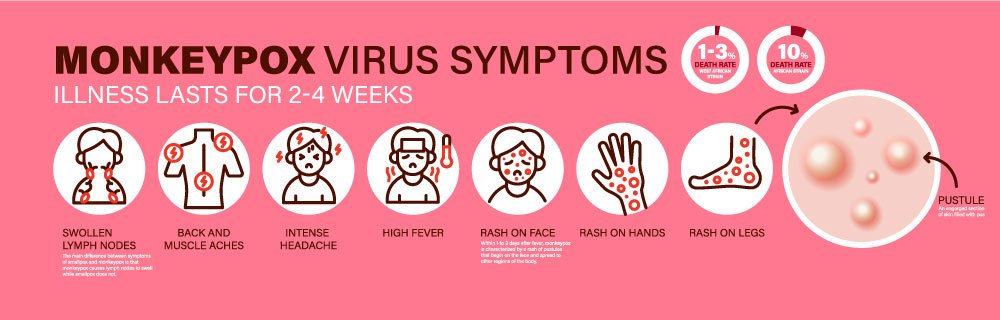 MonkeyPox Virus Symptoms